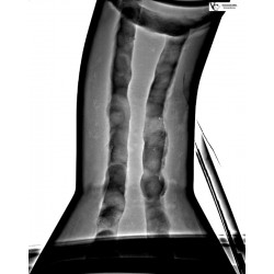 Sistem mobil pentru inspectie cu raze X VisiConsult Xplus Mobile